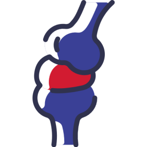 Arthritis